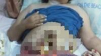 Mengidap Peyakit Infeksi Usus dan Tumor,Ibu Isnatun Butuh Uluran Tangan