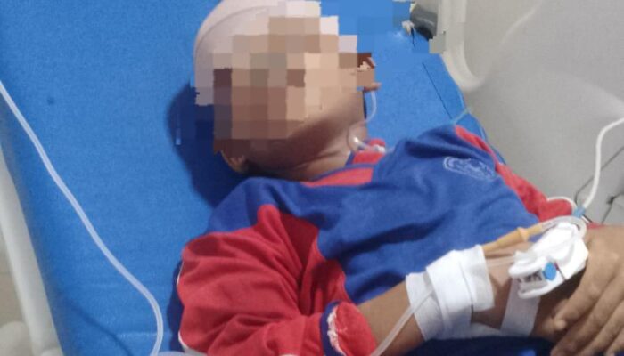 Siswa SD Jadi Korban Tabrak Lari di Lintas Sumatera Pringsewu, Sopir Truk Diminta Bertanggung Jawab